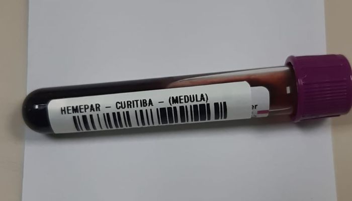 Foto: SESA Fevereiro Laranja: mês da conscientização sobre leucemia reforça importância do diagnóstico